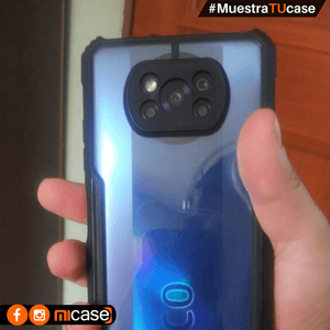 ▶️ Carcasa Personalizada Xiaomi Poco X3-X3 NFC-X3 PRO